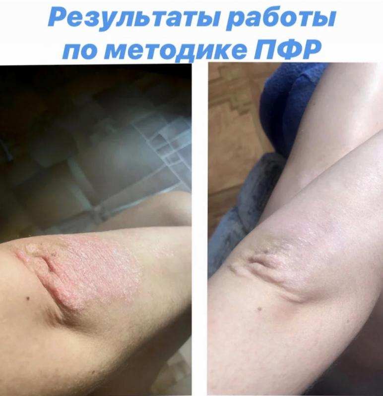 - 